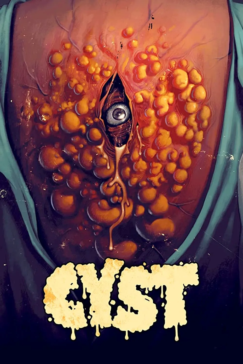 ภาพยนตร์ Cyst ซับไทย ครบทุกตอน ดูฟรี HD